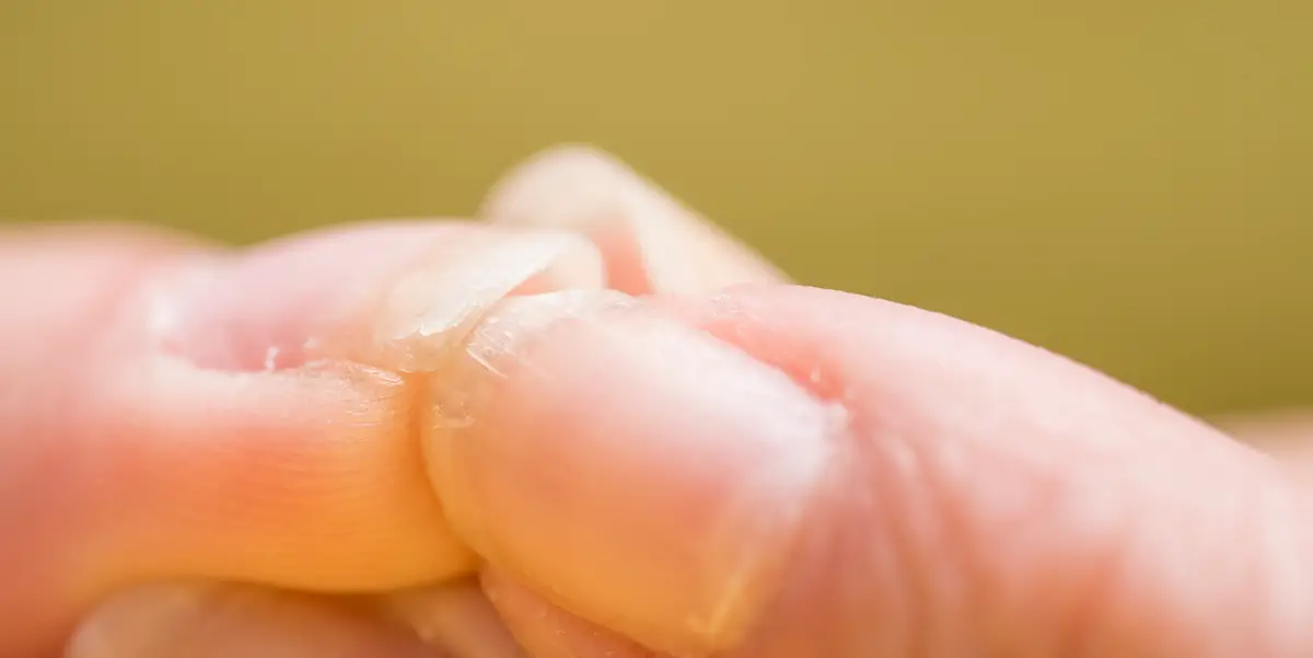 10 Reasons For Brittle Nails