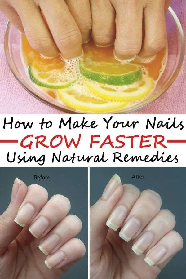 1000+ images about nail growth on Pinterest