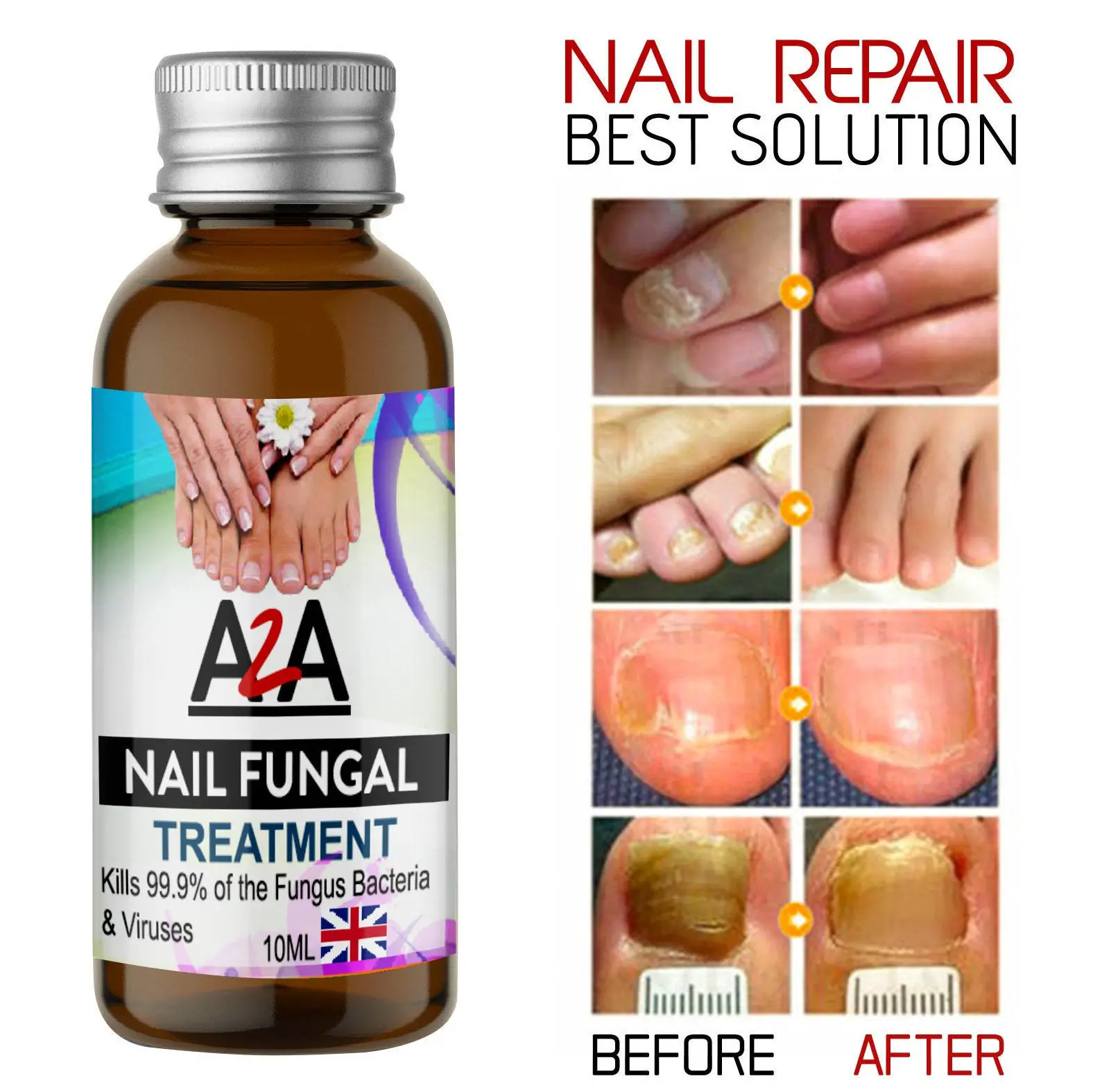 10ML Fungal Nail Treatment Highly Effective Kill Nail Fungus
