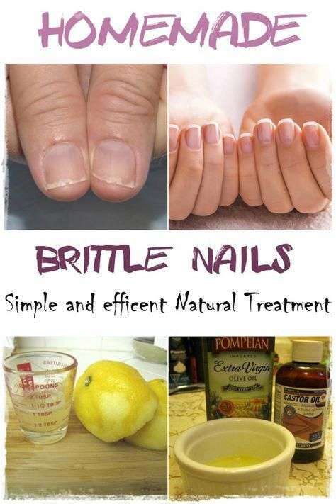 11 Effective Remedies to repair Dry, Brittle Nails # ...