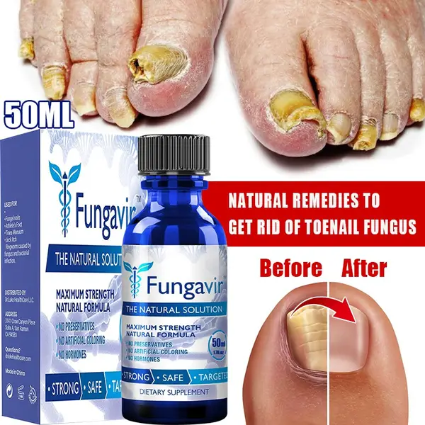 2021 EXTRA STRONG Nail Fungus Treatment, Best Nail Repair, Stop Fungal ...