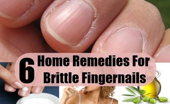 6 Brittle Fingernails Home Remedies, Natural Treatments ...