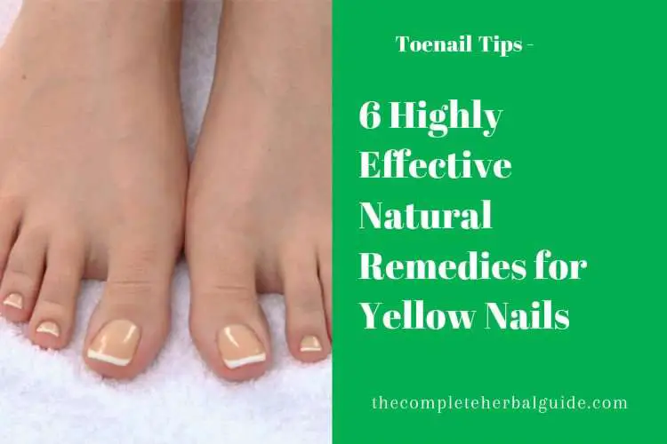 6 Highly Effective Yellow Toenail Cures
