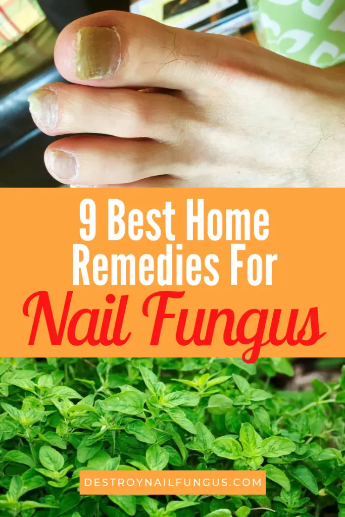 9 Best Home Remedies For Nail Fungus: What Really Works?