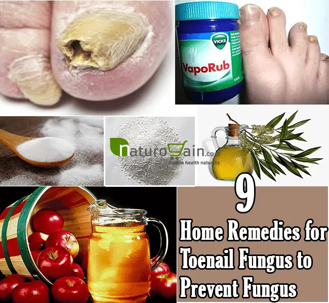 9 Best Home Remedies for Toenail Fungus to Prevent Infection