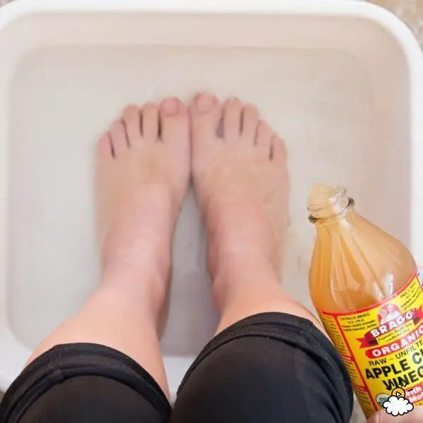 9 Cheap, Easy Home Remedies to Clear Up Yucky Toenail Fungus #NailHack ...
