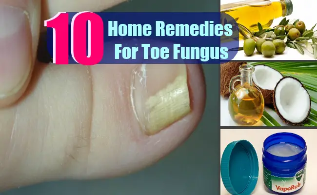Acne Home Remedies For Dry Skin: Fungus Toes Home Remedies