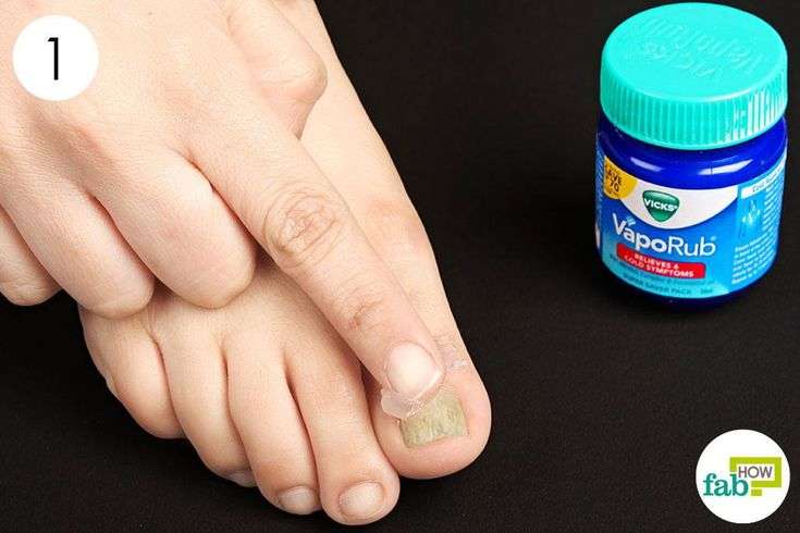 apply vicks vaporub on toenail fungus