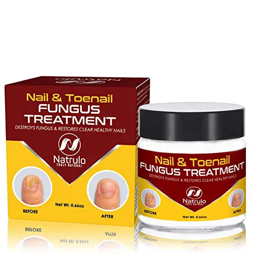 Best and Coolest 21 Toenail Fungus Treatments