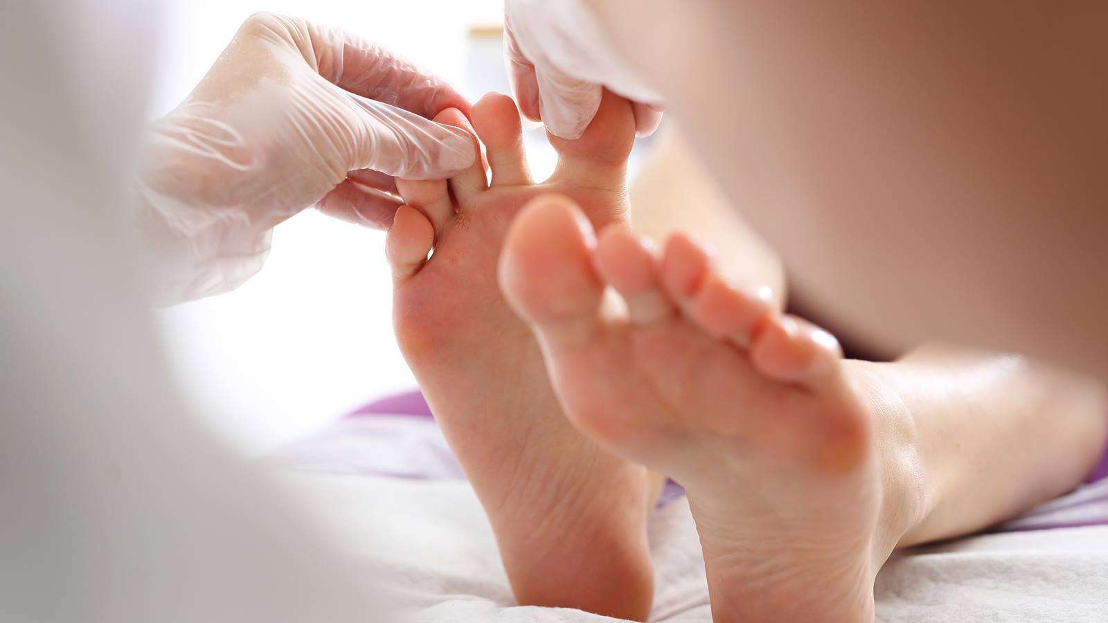 Caring for an Infected or Ingrown Toenail