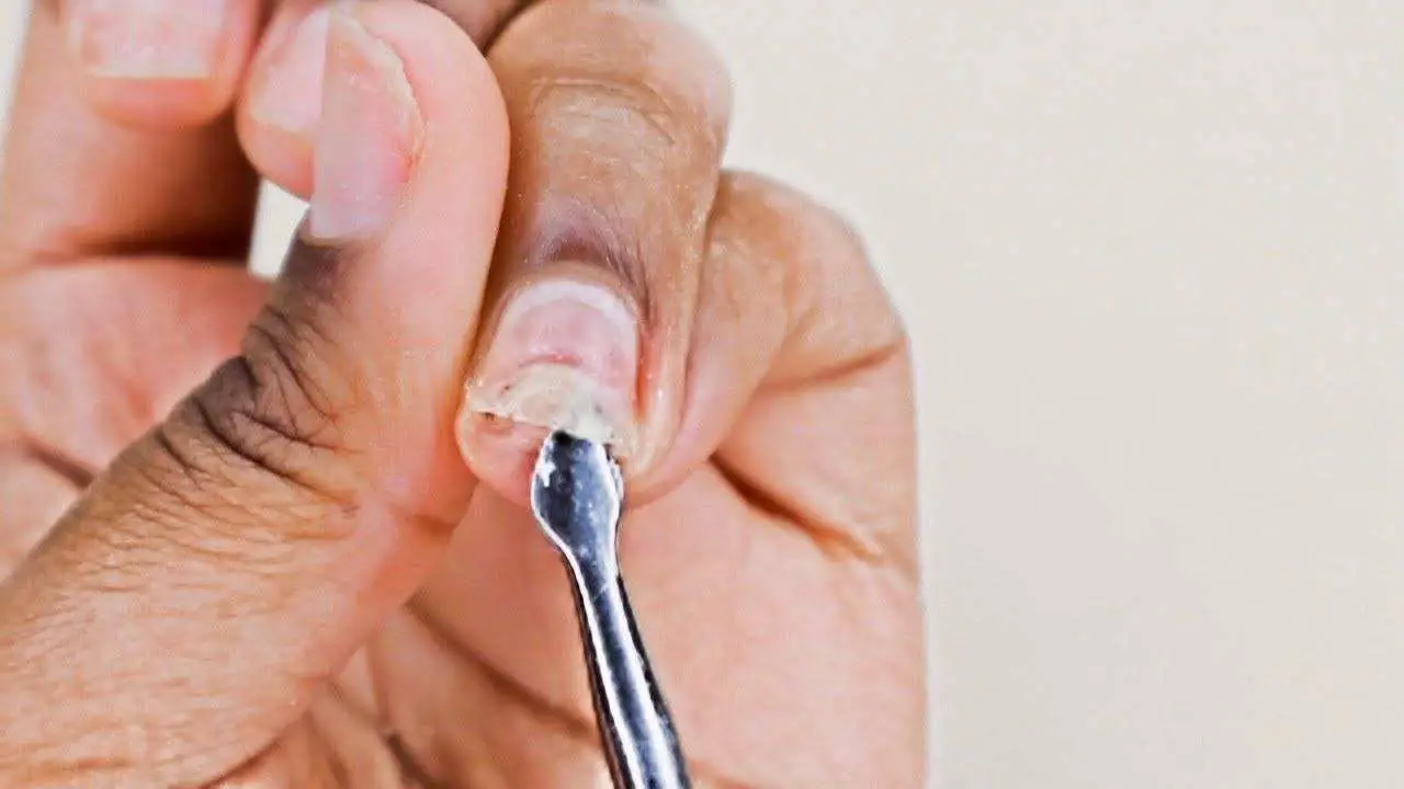 Damaged nails repairð±