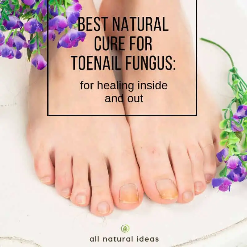 Discover the Best Natural Cure for Toenail Fungus
