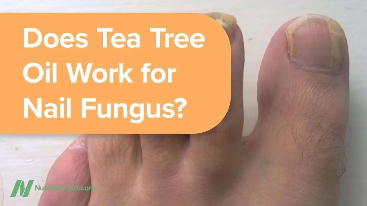 Does Tea Tree Oil Work for Nail Fungus?