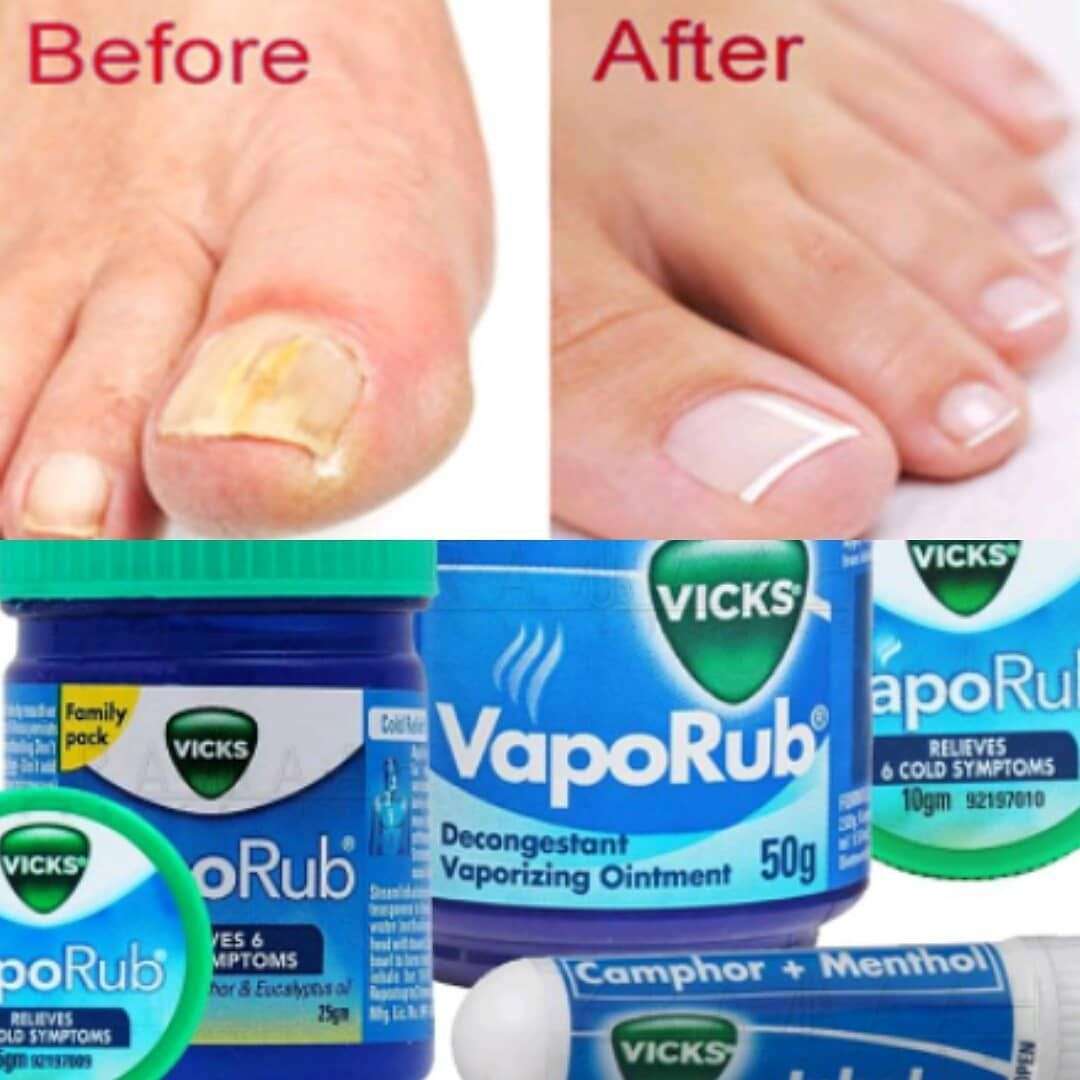 Does Vicks VapoRub or other home remedies really work on ...