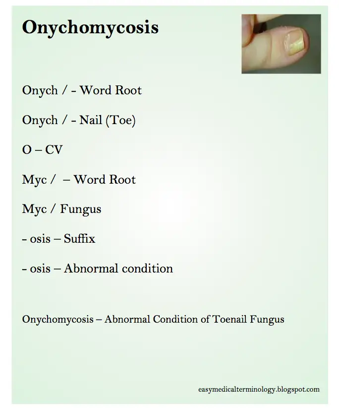 Easy Medical Terminology : Onychomycosis Toenail Fungus