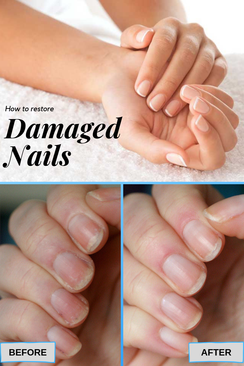 Expert Tips to Damaged Nails