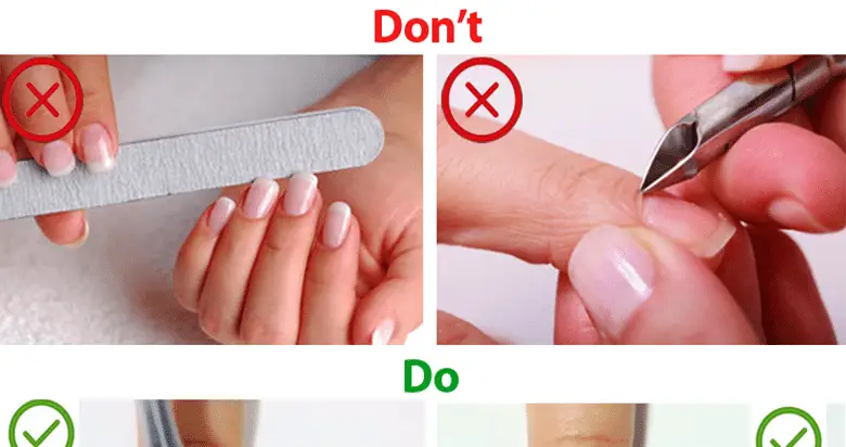Grow your nails using these easy home remedies!!