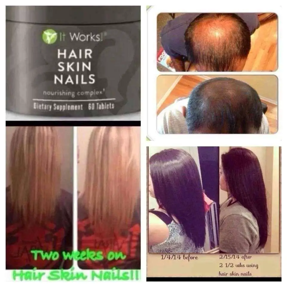 Hair Skin Nails just amazing!!! Give it a try!!! www ...