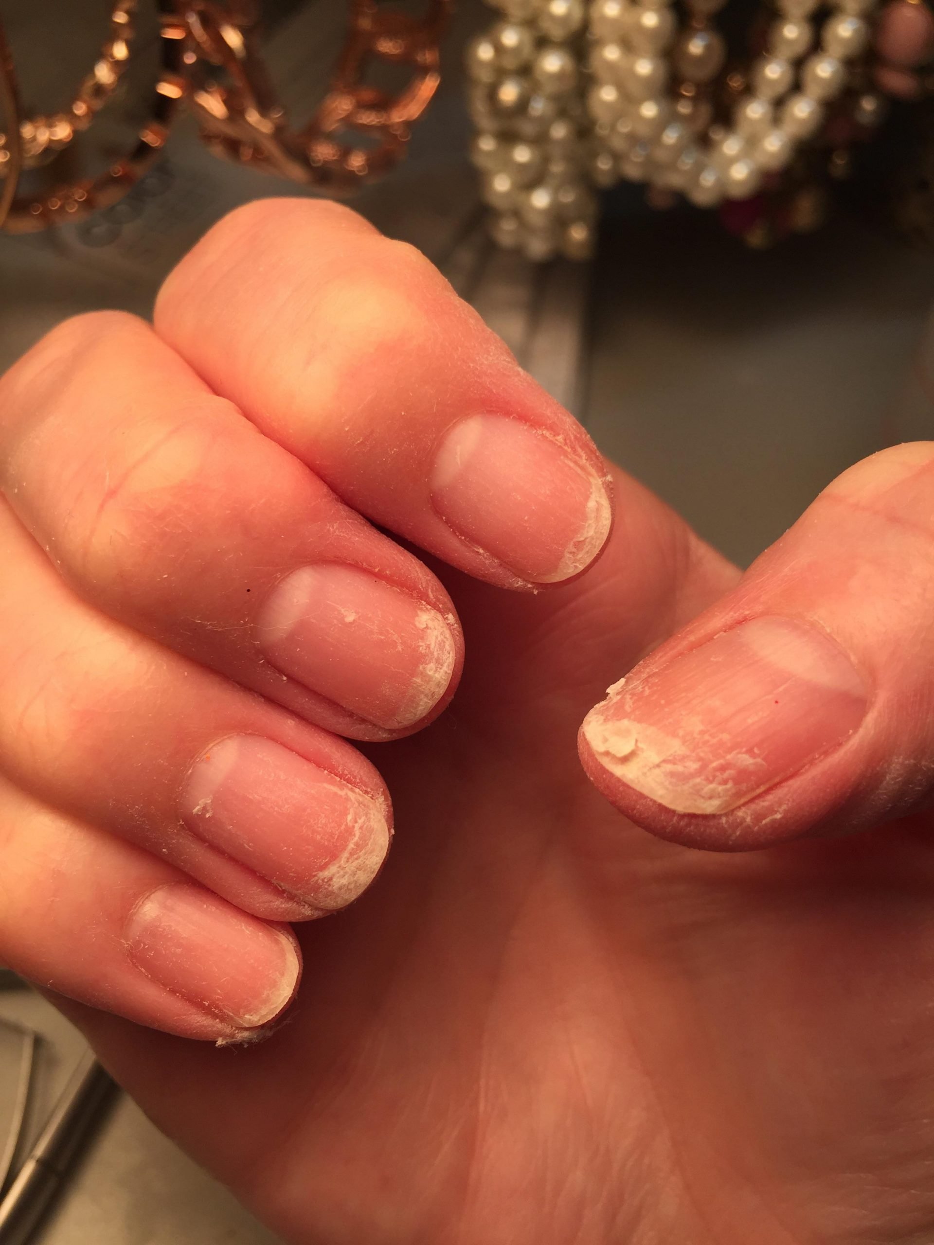 Help! My nails are peeling. What are your favorite ...