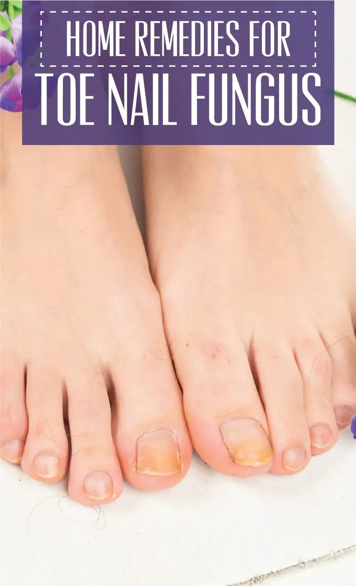 Home Remedies for Toe Nail Fungus