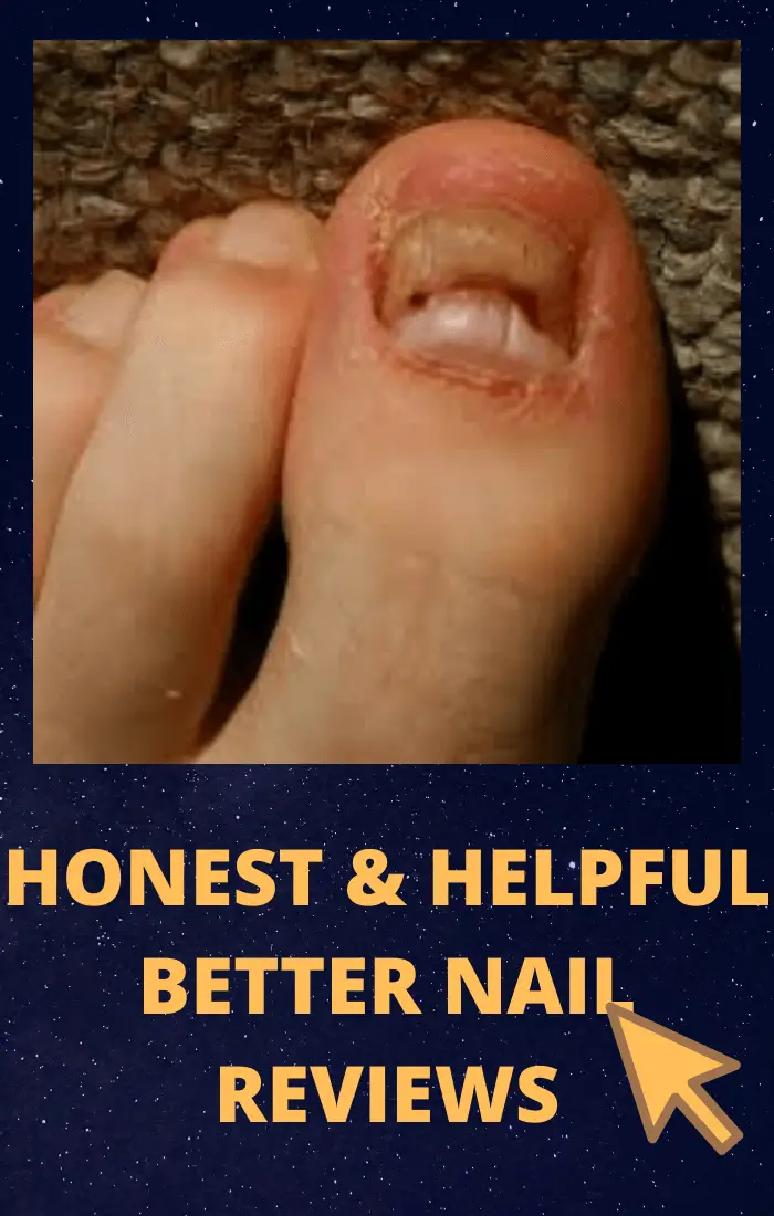 Honest &  Helpful Better Nail Reviews In 2021