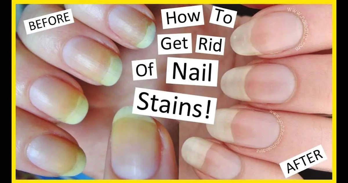How Can I Remove Nail Polish Stains From My Nails