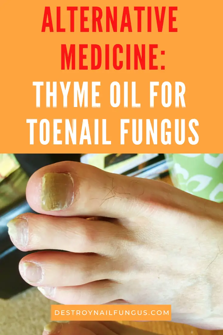 How Can You Use Thyme Oil for Toenail Fungus Treatment?