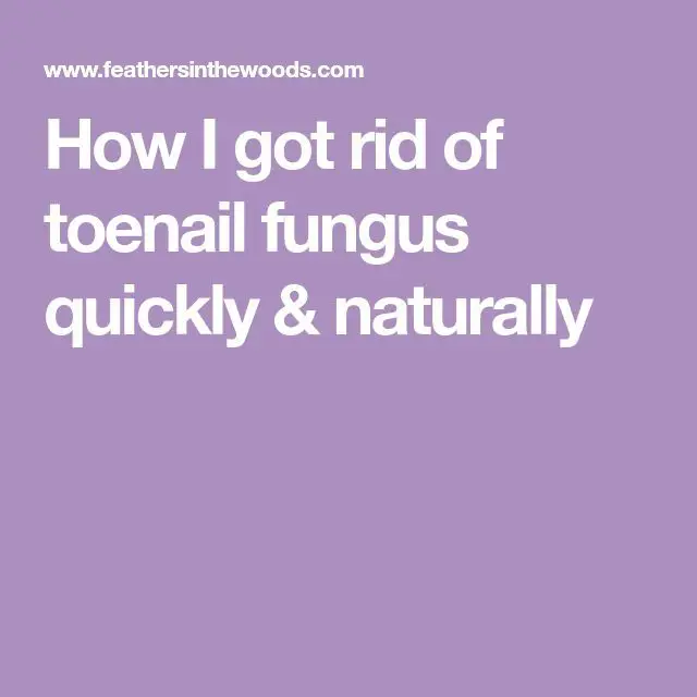 How I got rid of toenail fungus quickly &  naturally