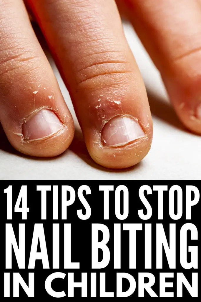 How to Get Kids to Stop Biting Their Nails: 14 Tips for ...
