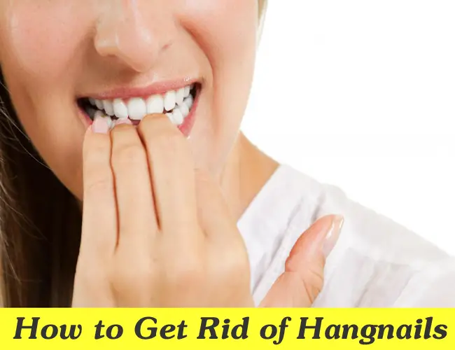 How to Get Rid of Hangnails