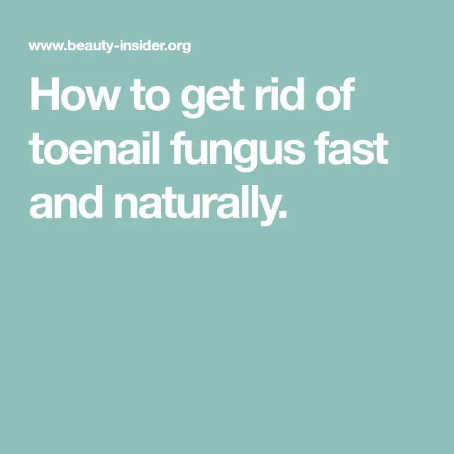 How to Get Rid of Toenail Fungus Fast and Naturally (With images ...
