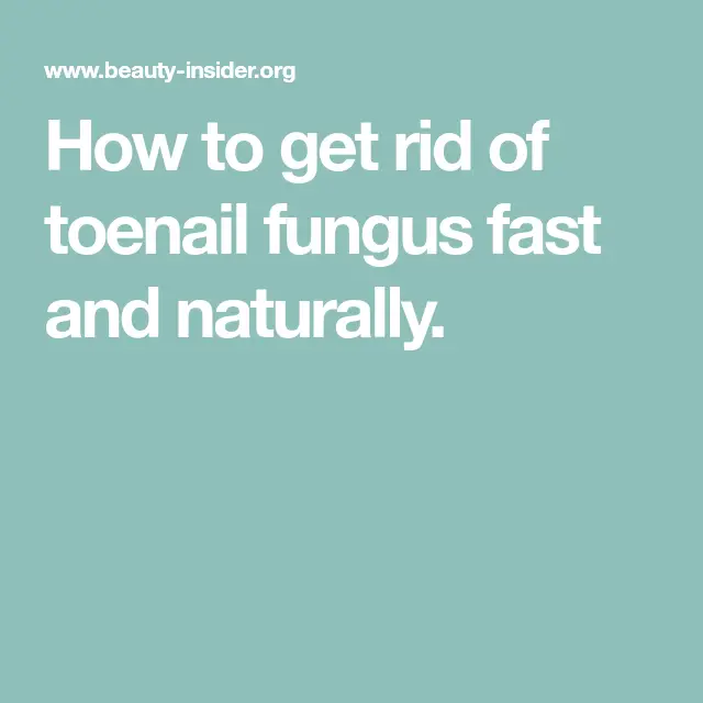 How to Get Rid of Toenail Fungus Fast and Naturally (With images ...