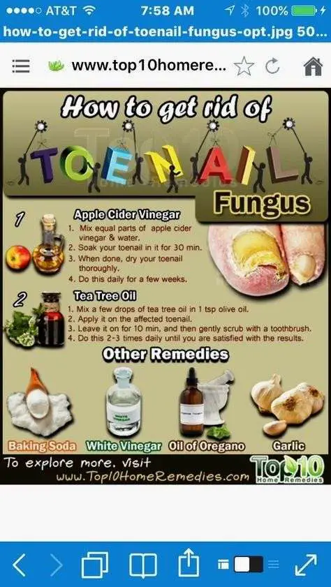 How to get rid of Toenail Fungus