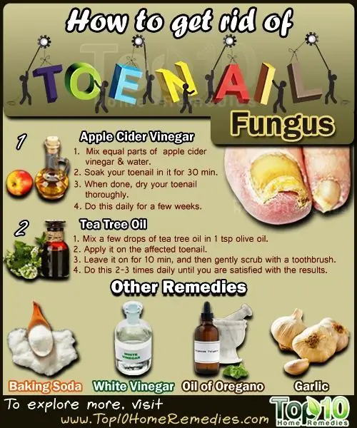 How to Get Rid of Toenail Fungus. Try these natural remedies to get rid ...