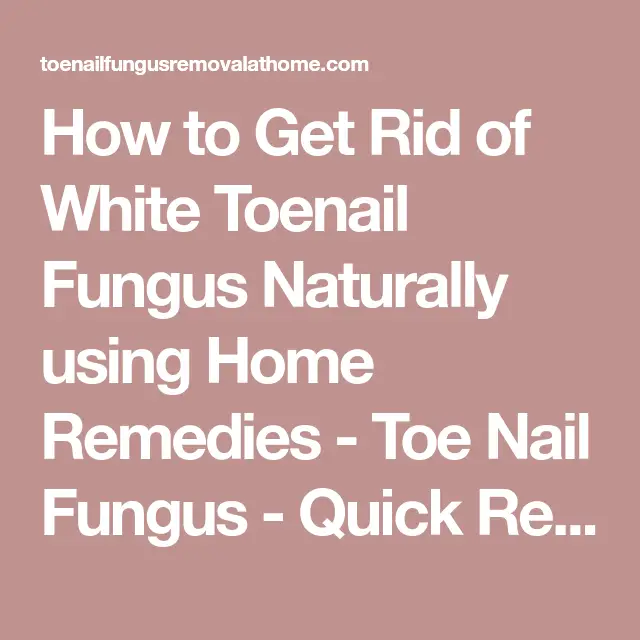 How to Get Rid of White Toenail Fungus Naturally using Home Remedies ...