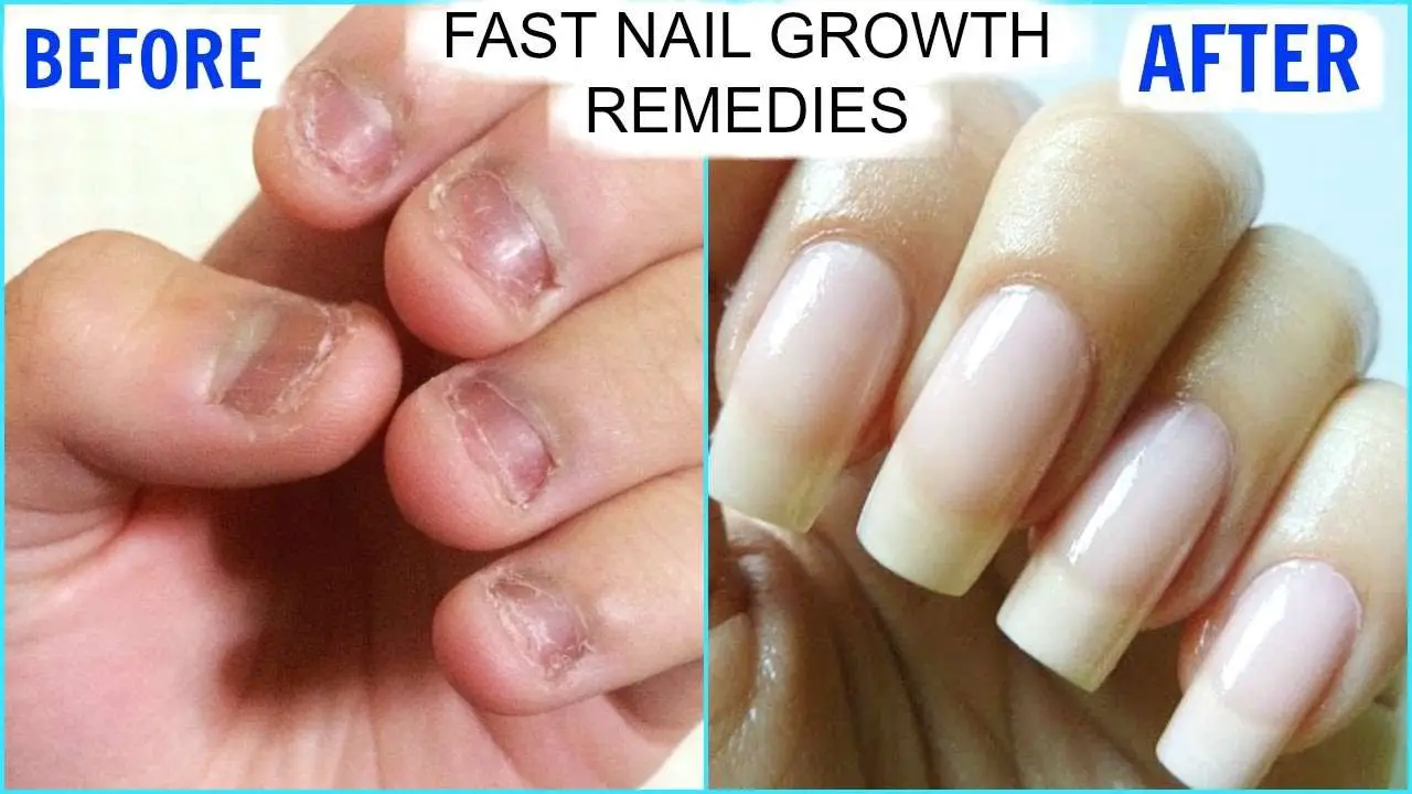 How To GROW Long Strong Nails Fast At Home ...