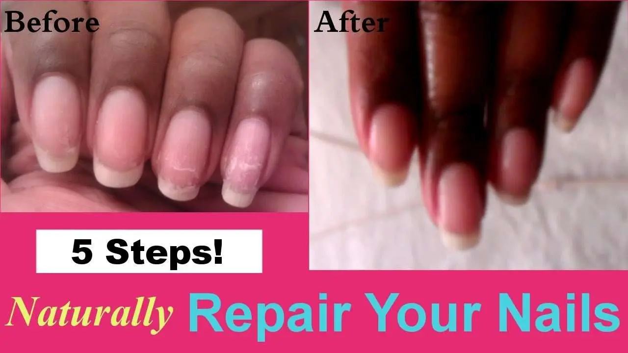 How to heal nails after gel