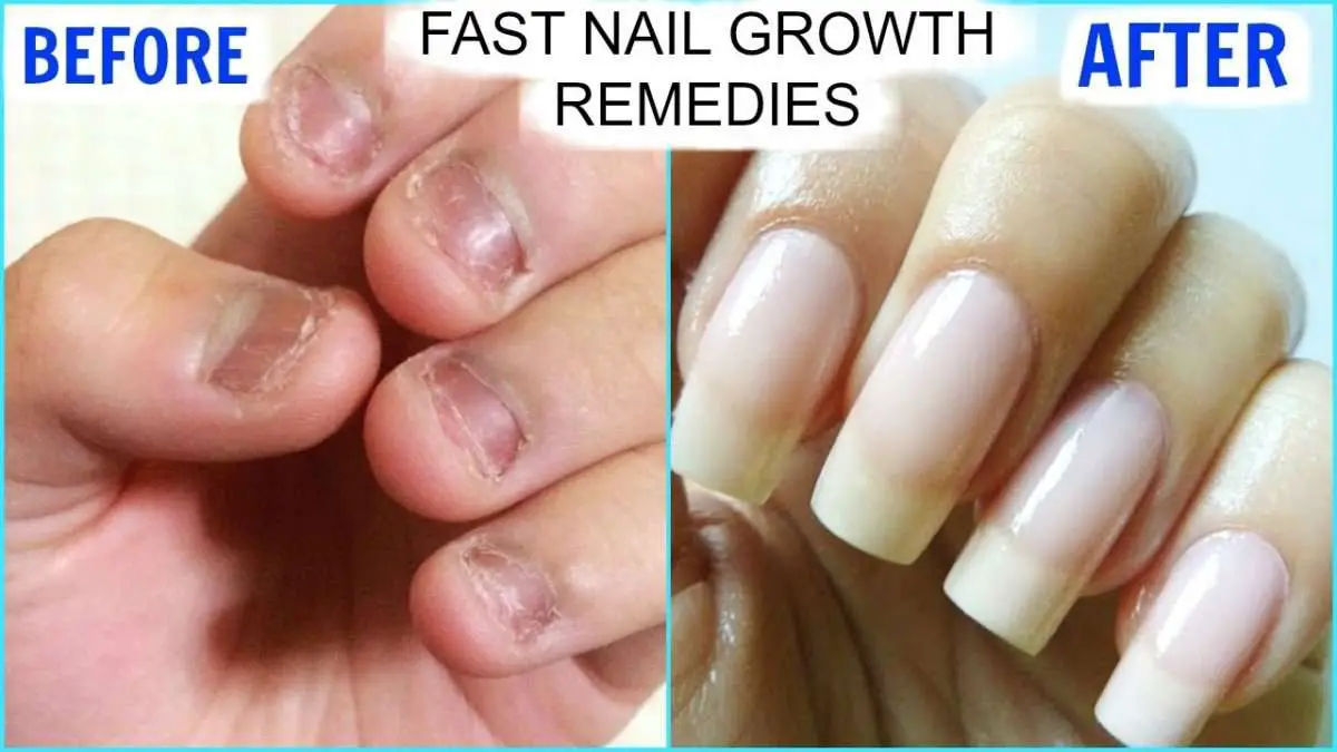 HOW TO MAKE NAILS GROW FASTER AND STRONGER?