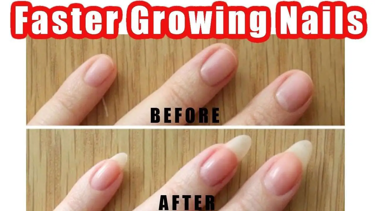 How to Make Your Nails Grow Fast Overnight?  Best Ways ...