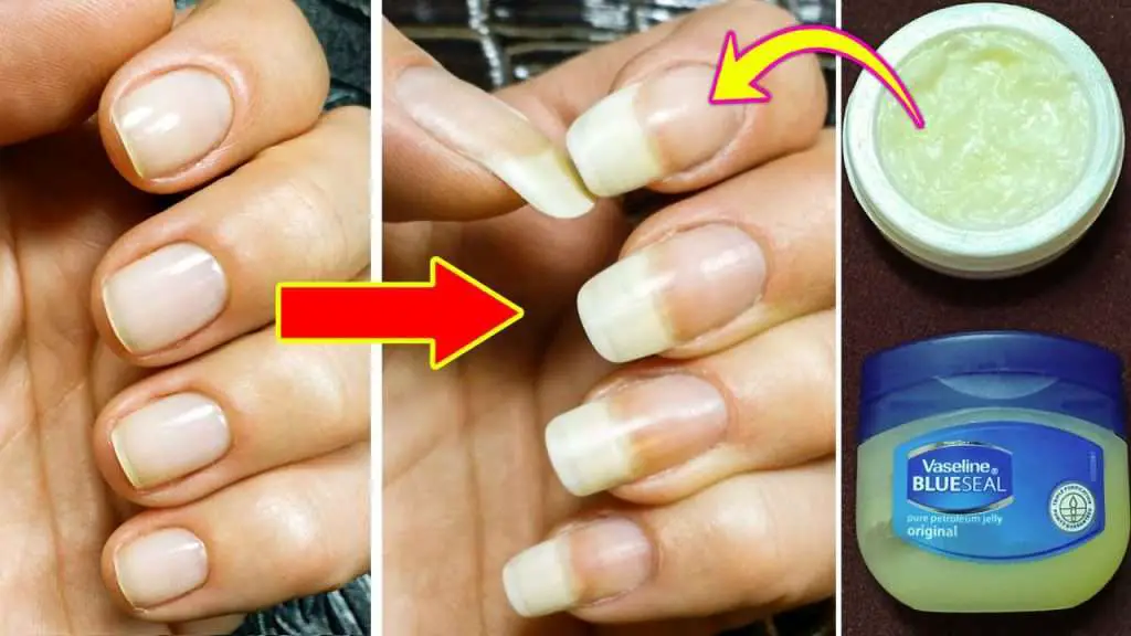 How To Make Your Nails Grow Faster And Stronger, Get Long ...