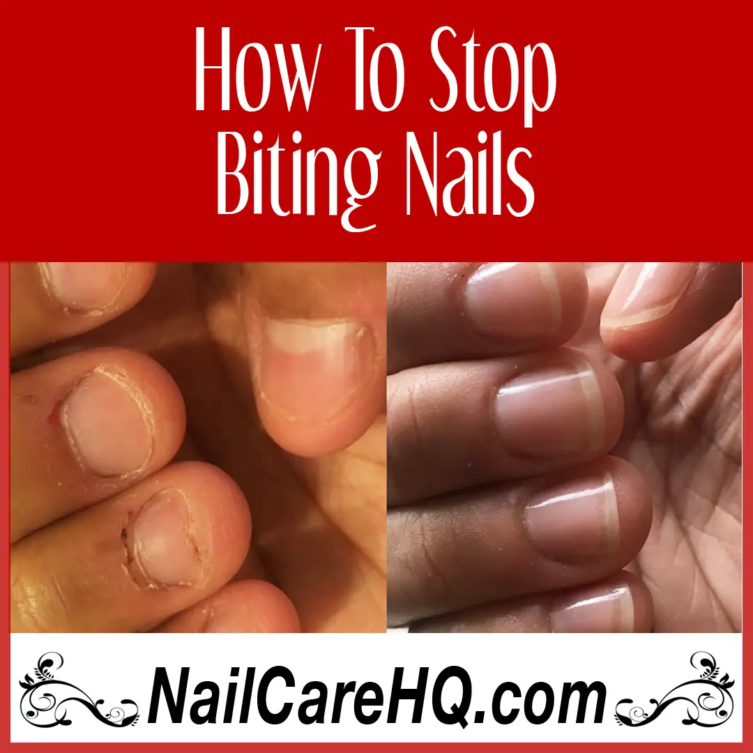 How To Stop Biting Nails â Angela