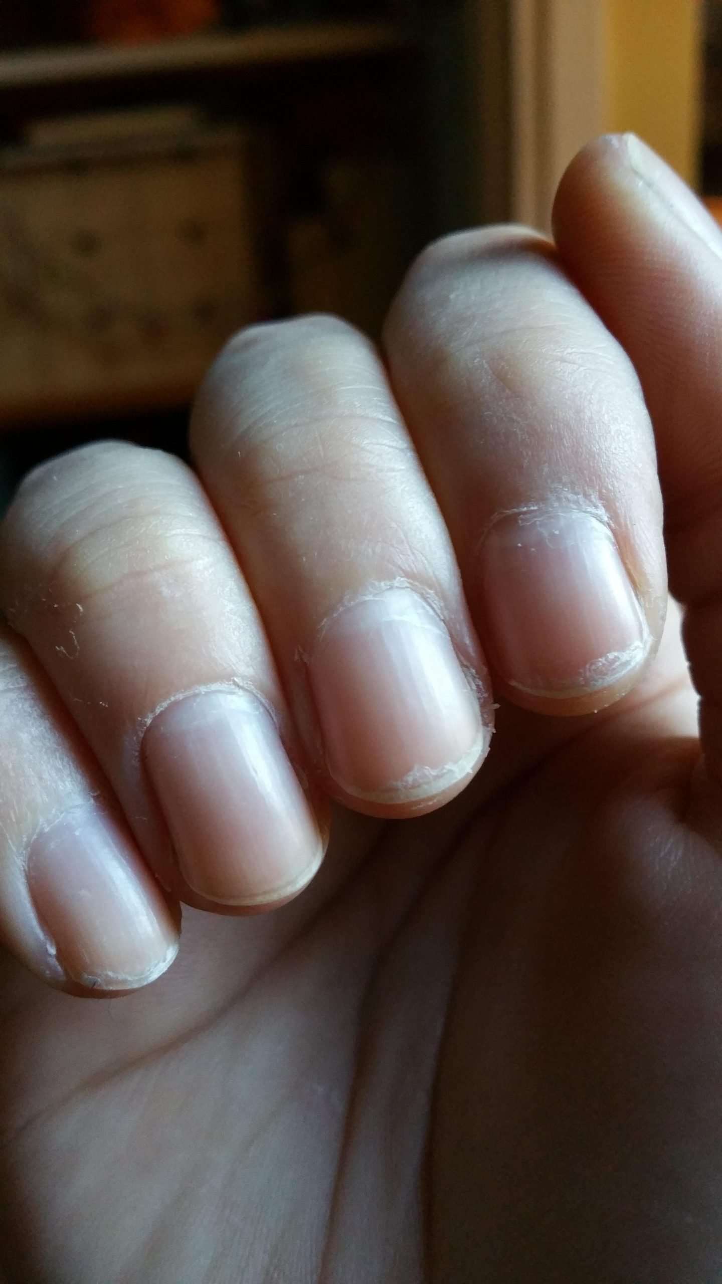 How To Stop Peeling My Nails