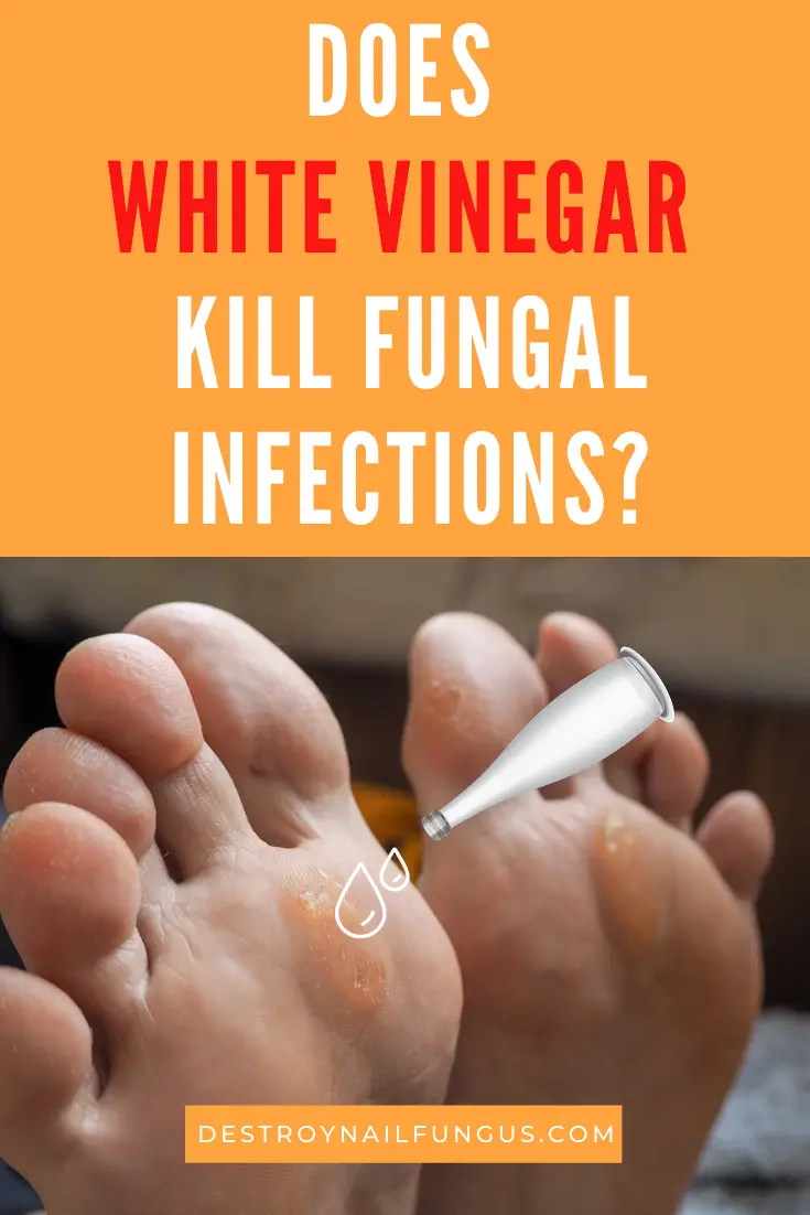Is White Vinegar Antifungal? Everything You Need To Know