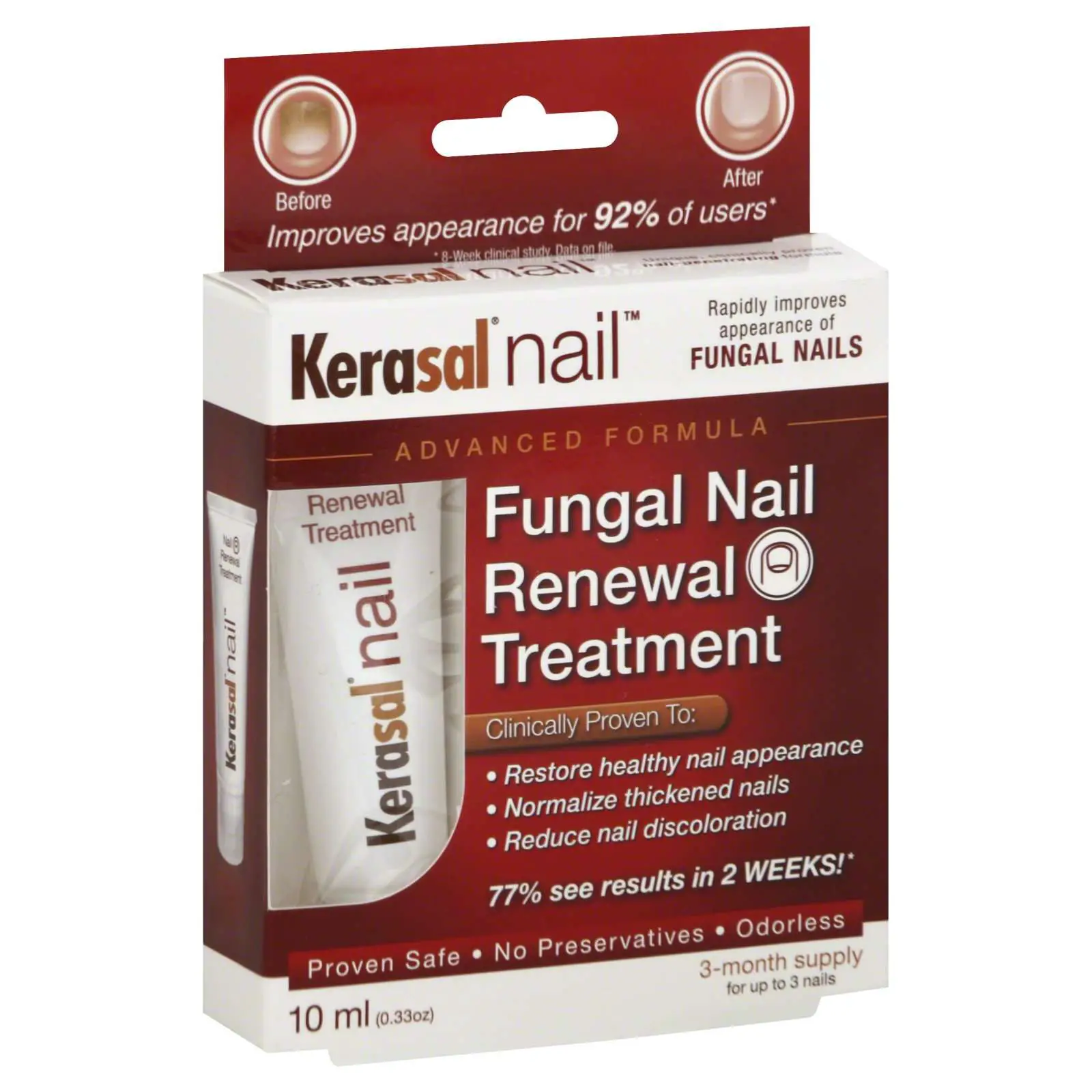 Kerasal Fungal Nail Renewal Treatment, 0.33 oz (10 ml)
