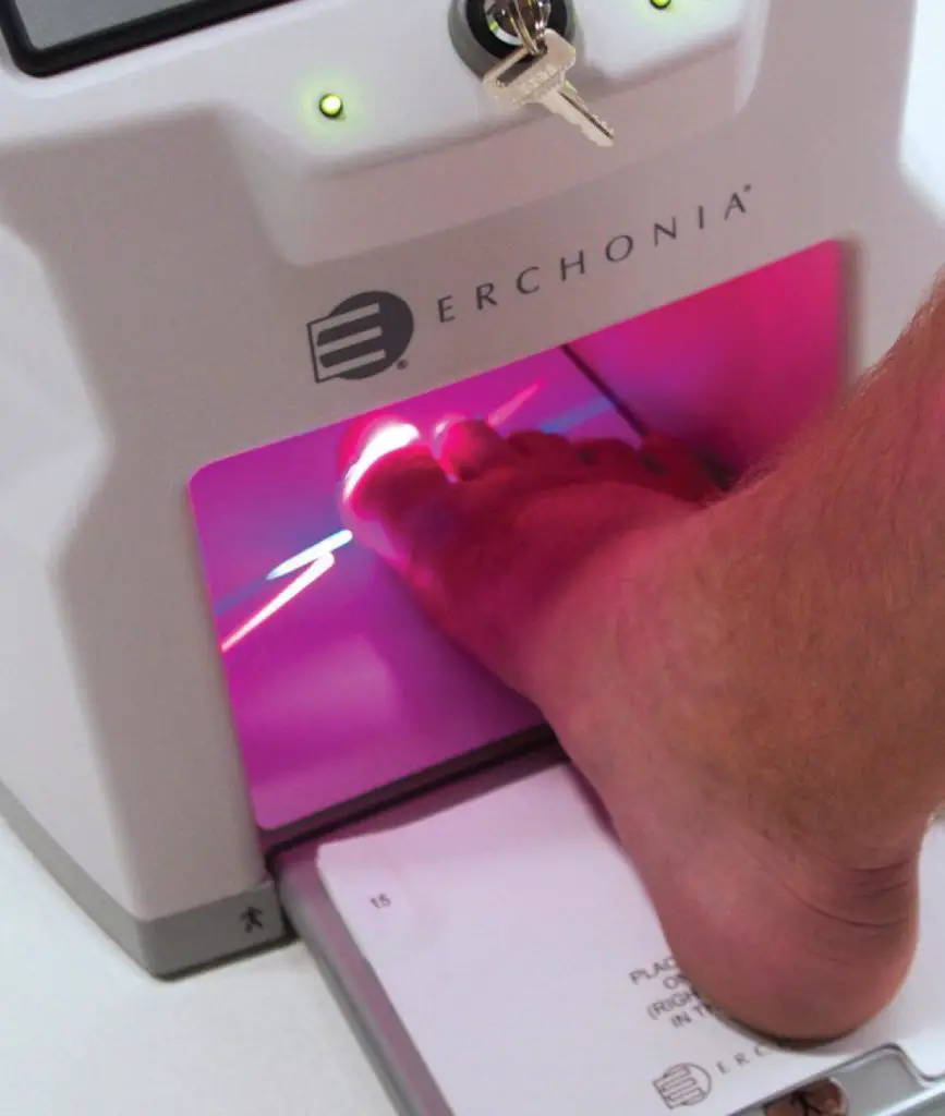 Laser Therapy For Toenail Fungus Specialist