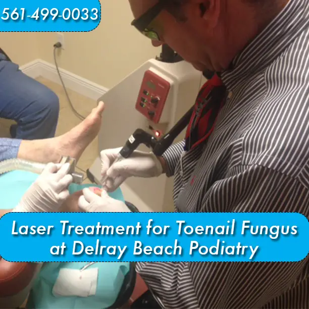 Laser Treatment for Fungal Nails at Delray Beach Podiatry