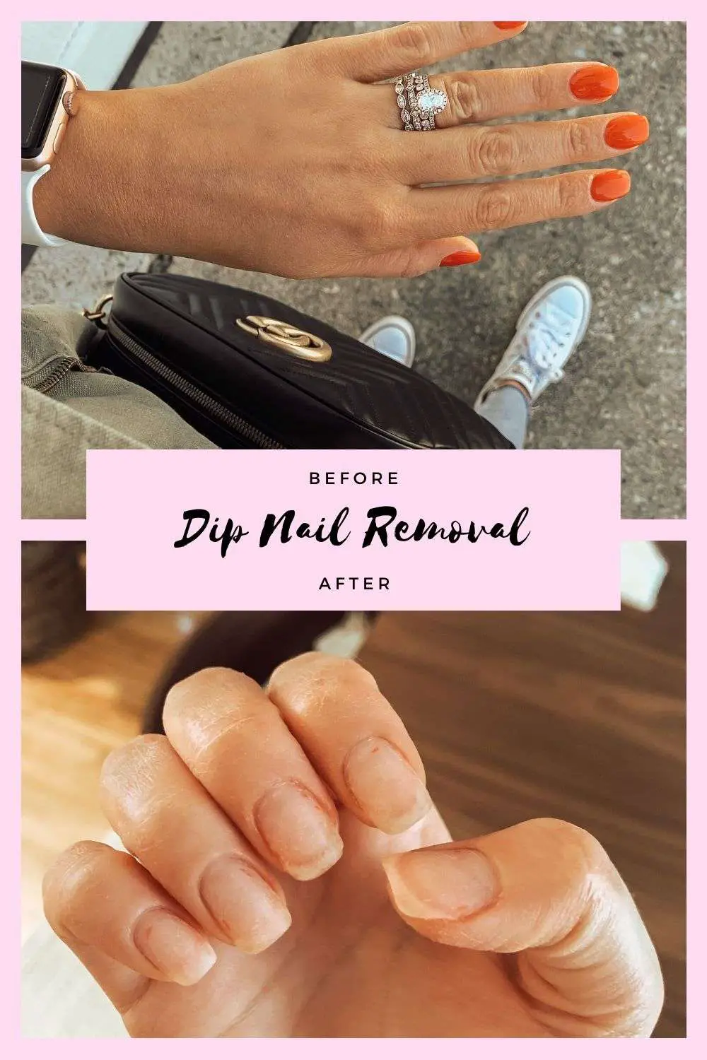 N I C H O L L E S O P H I A: How To Remove Dip Nails At Home