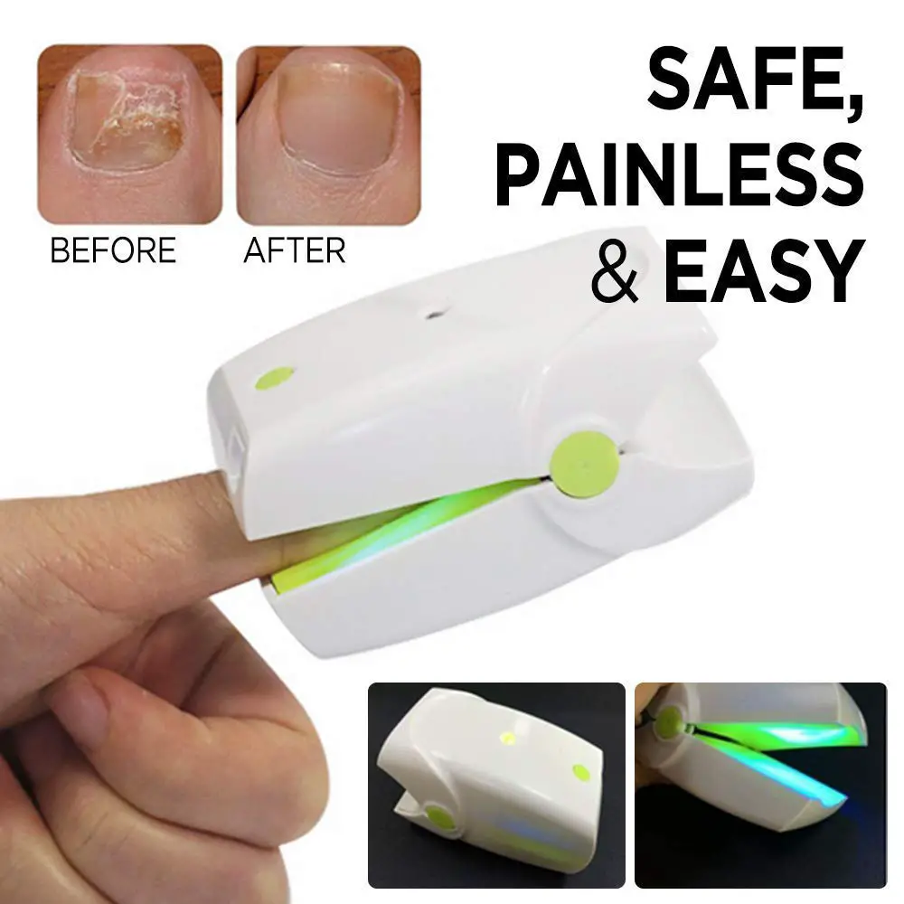Nail Fungus Cleaning Laser Device Cold Laser Therapy Physical Therapy ...