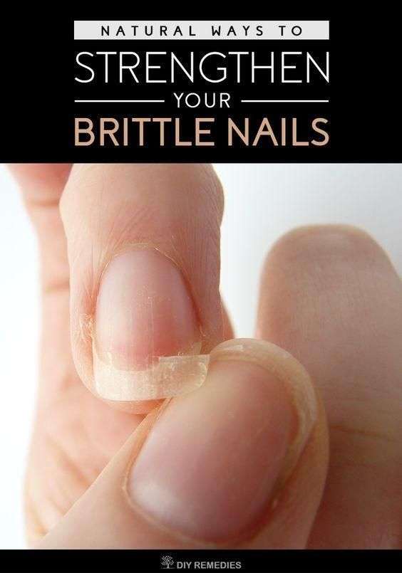 Natural Ways To Strengthen Your Brittle Nails