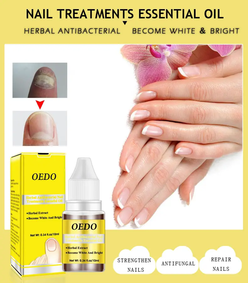 OEDO Fungal Nail Treatment Essence Oil Nail and Foot Whitening Toe Nail ...